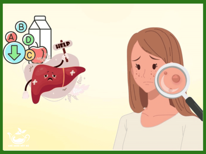 8 Tác Dụng Của Bột Diếp Cá
